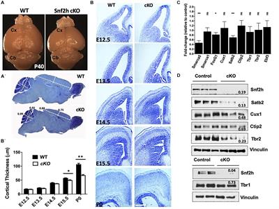 Snf2h Drives Chromatin Remodeling to Prime Upper Layer Cortical Neuron Development